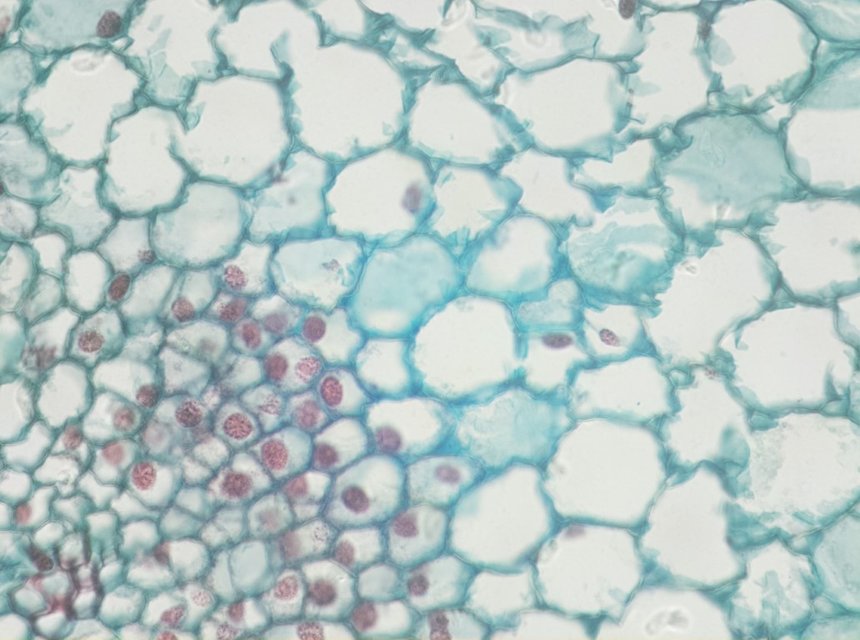 Micrograph of a bean root