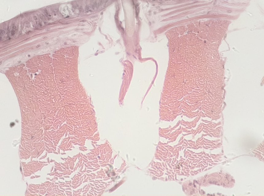 Micrograph of fine biological structures