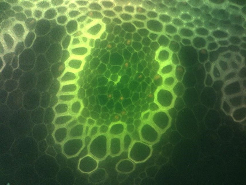 Fluorescence micrograph of plant tissue