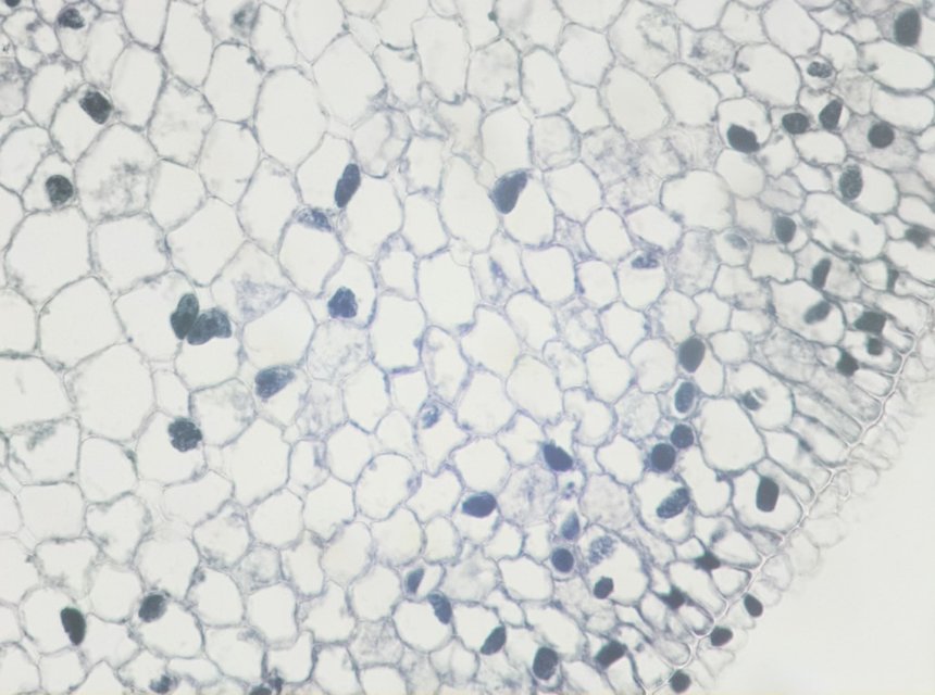 Micrograph of an onion root
