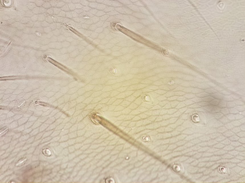 Micrograph of an arthropod specimen