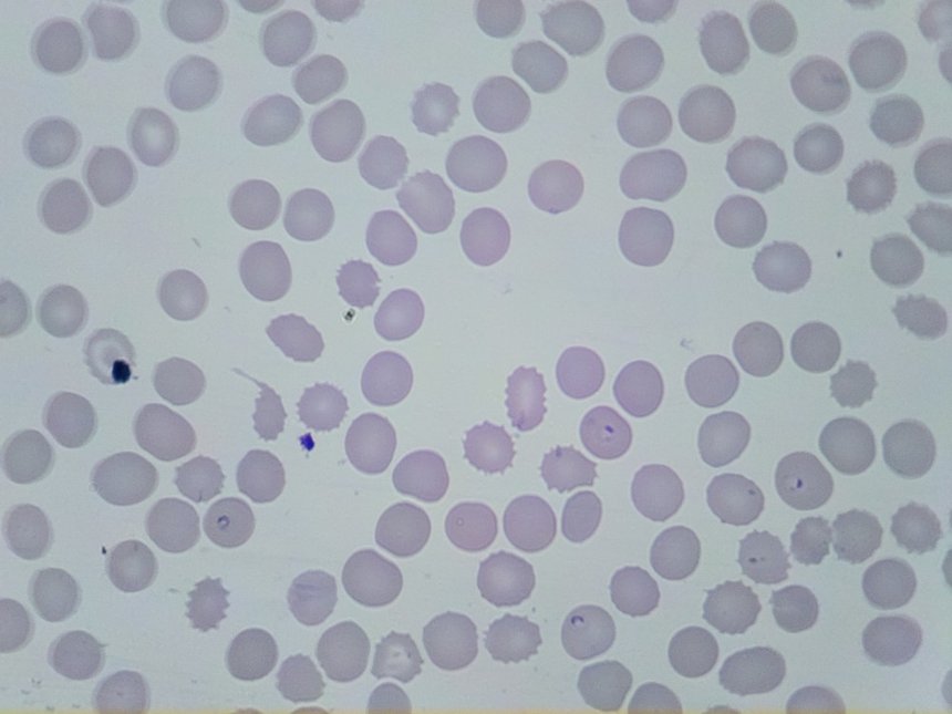 Micrograph of a thin blood smear