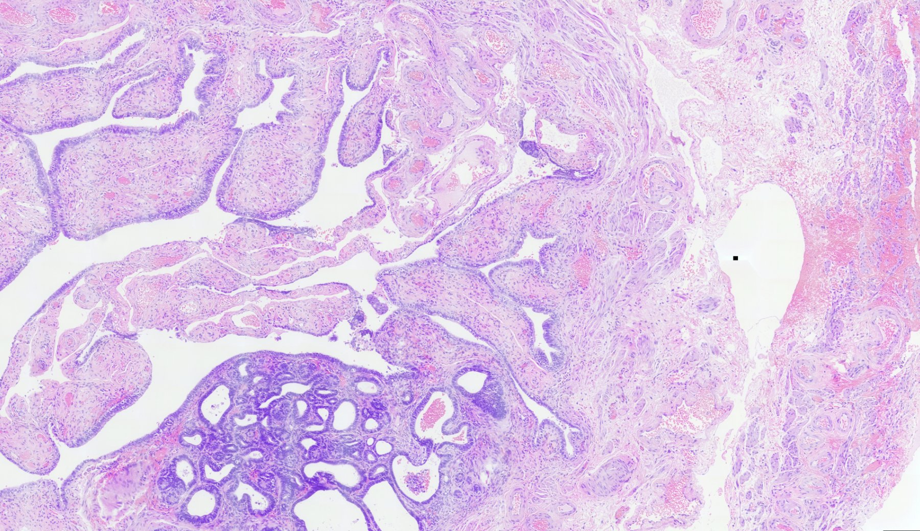 Microscope image of a fallopian tube sample