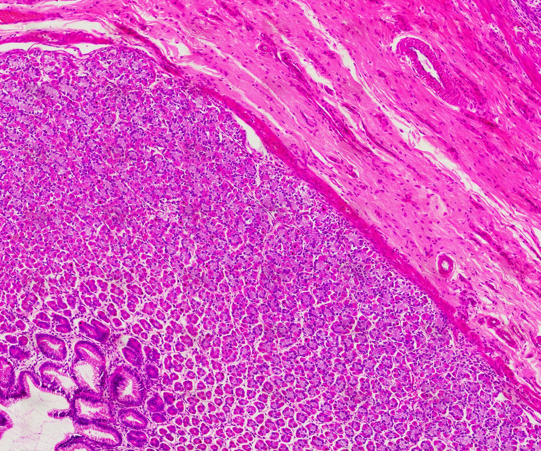 A cropped section of a scan of stomach tissue.